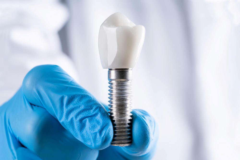 implant